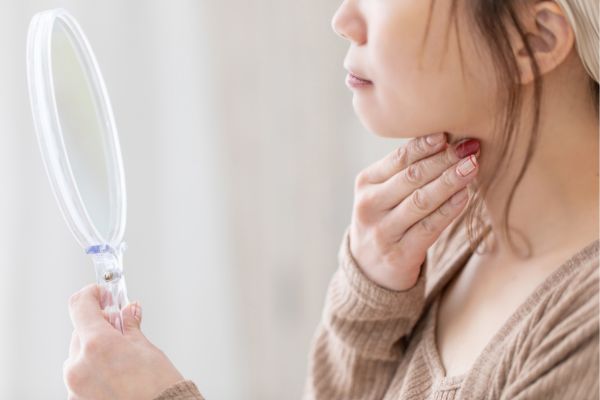 肌悩みのある女性
